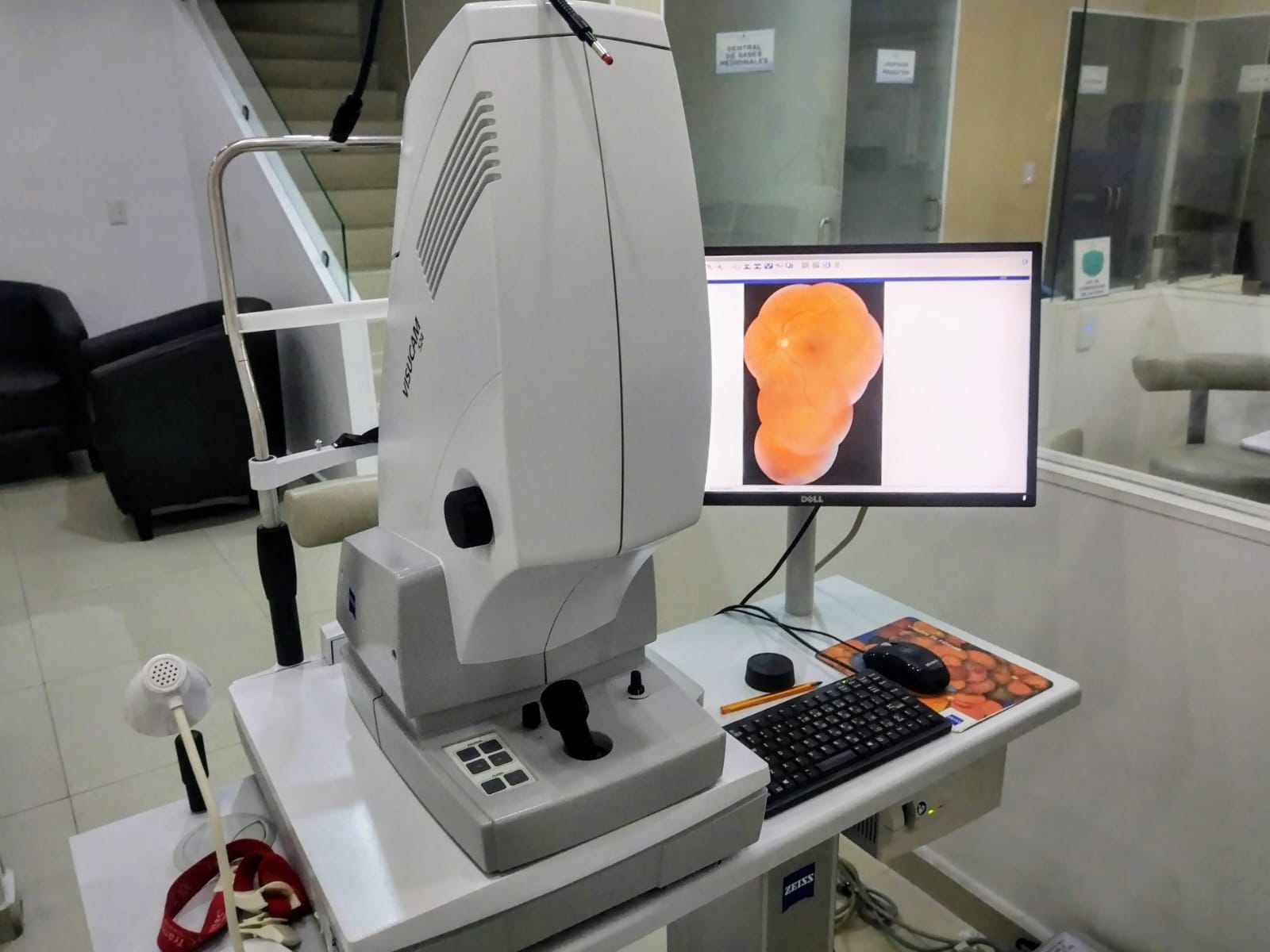 Imagen de Cámara de fondo y angiografía de retina