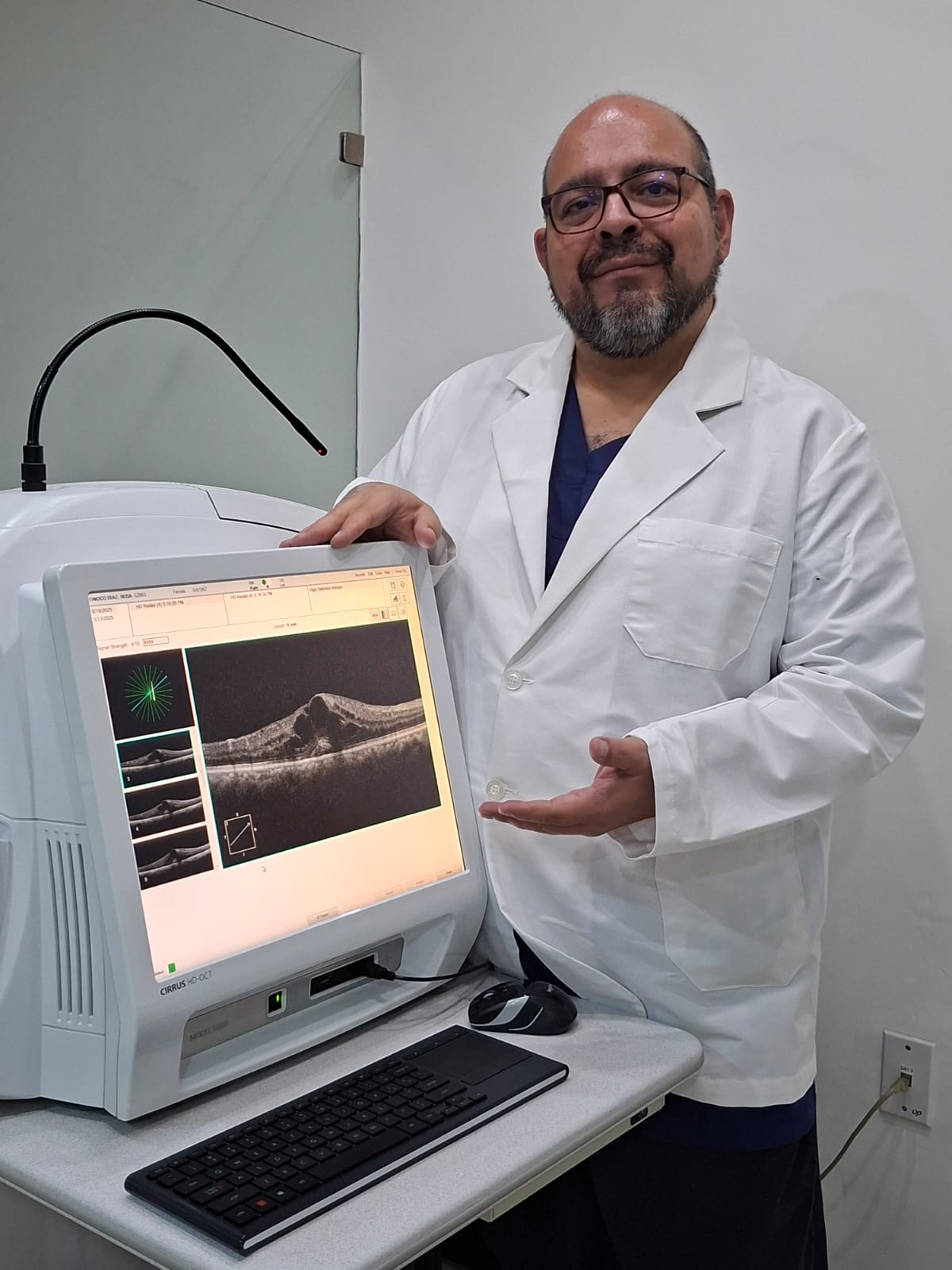 Imagen de OCT o Tomografía de Coherencia Optica